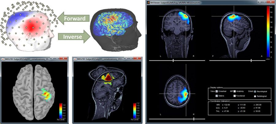 McConnell_Brain_Figure_4_w.jpg