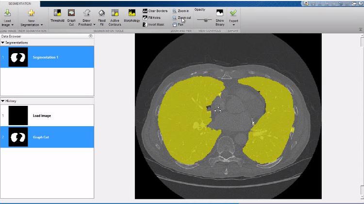 3D Image Processing - MATLAB & Simulink