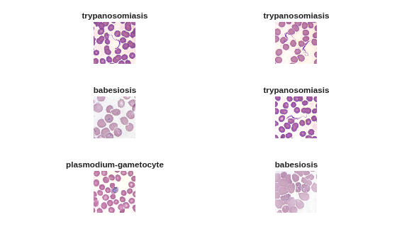 Figure contains 6 axes objects. Hidden axes object 1 with title trypanosomiasis contains an object of type image. Hidden axes object 2 with title trypanosomiasis contains an object of type image. Hidden axes object 3 with title babesiosis contains an object of type image. Hidden axes object 4 with title trypanosomiasis contains an object of type image. Hidden axes object 5 with title plasmodium-gametocyte contains an object of type image. Hidden axes object 6 with title babesiosis contains an object of type image.