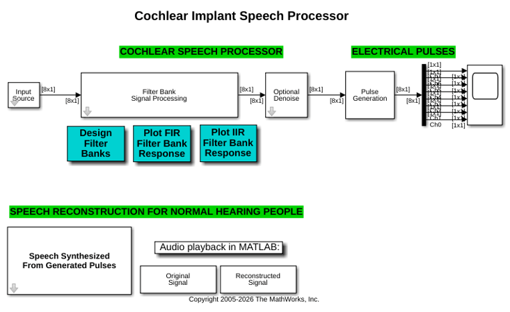 Cochlear Implant Speech Processor