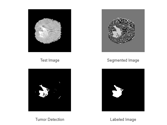 Figure contains 4 axes objects. Hidden axes object 1 with xlabel Test Image contains an object of type image. Hidden axes object 2 with xlabel Segmented Image contains an object of type image. Hidden axes object 3 with xlabel Tumor Detection contains an object of type image. Hidden axes object 4 with xlabel Labeled Image contains an object of type image.