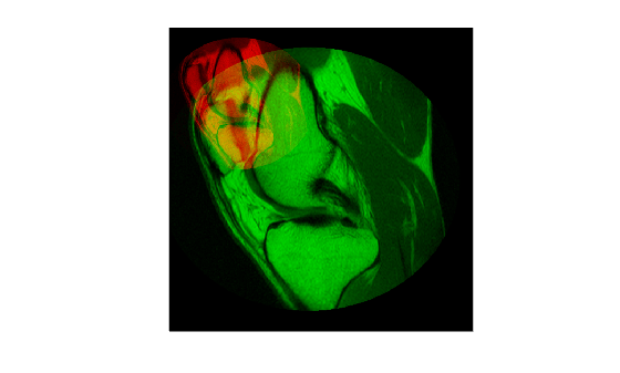 Figure contains an axes object. The hidden axes object contains an object of type image.