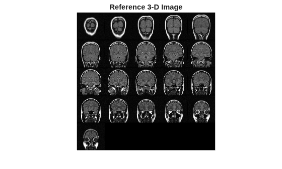Figure contains an axes object. The hidden axes object with title Reference 3-D Image contains an object of type image.