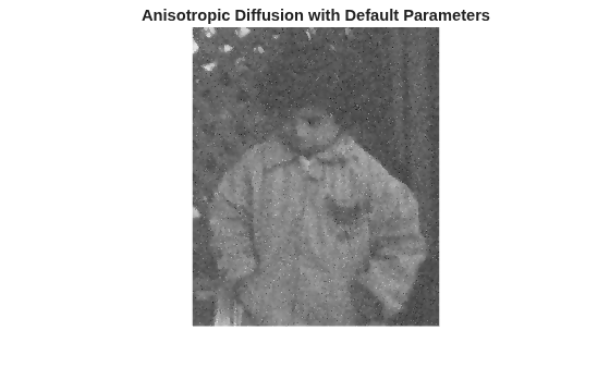 Figure contains an axes object. The hidden axes object with title Anisotropic Diffusion with Default Parameters contains an object of type image.