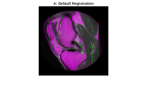 Figure contains an axes object. The hidden axes object with title A: Default Registration contains an object of type image.