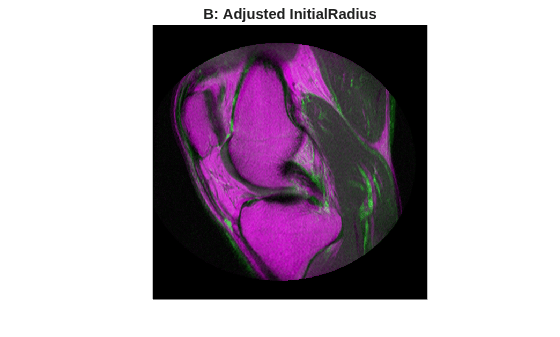 Figure contains an axes object. The hidden axes object with title B: Adjusted InitialRadius contains an object of type image.