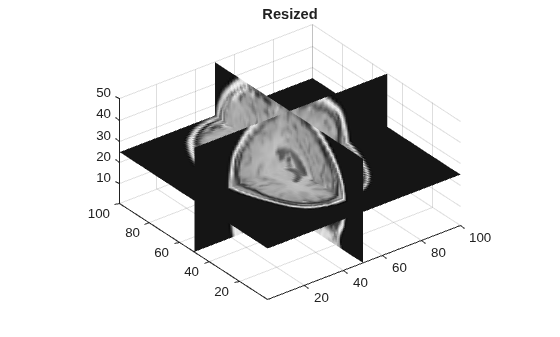 Figure contains an axes object. The axes object with title Resized contains 3 objects of type surface.