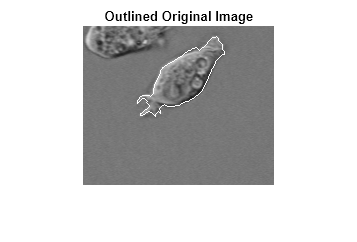 Detect Cell Using Edge Detection and Morphology