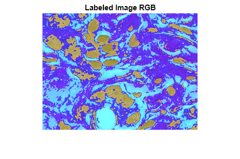 Figure contains an axes object. The hidden axes object with title Labeled Image RGB contains an object of type image.