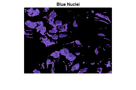 Figure contains an axes object. The hidden axes object with title Blue Nuclei contains an object of type image.