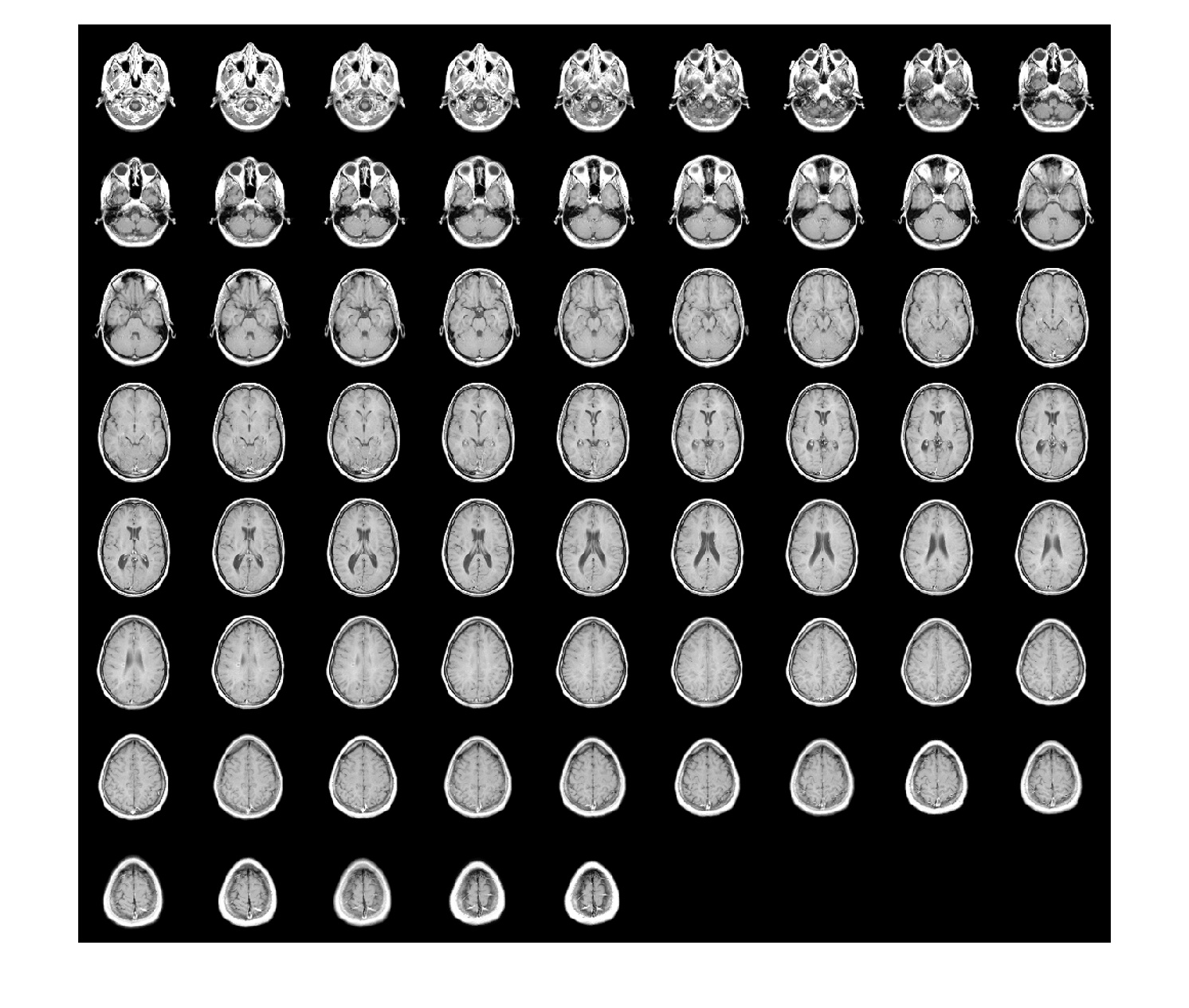 Figure contains an axes object. The hidden axes object contains an object of type image.