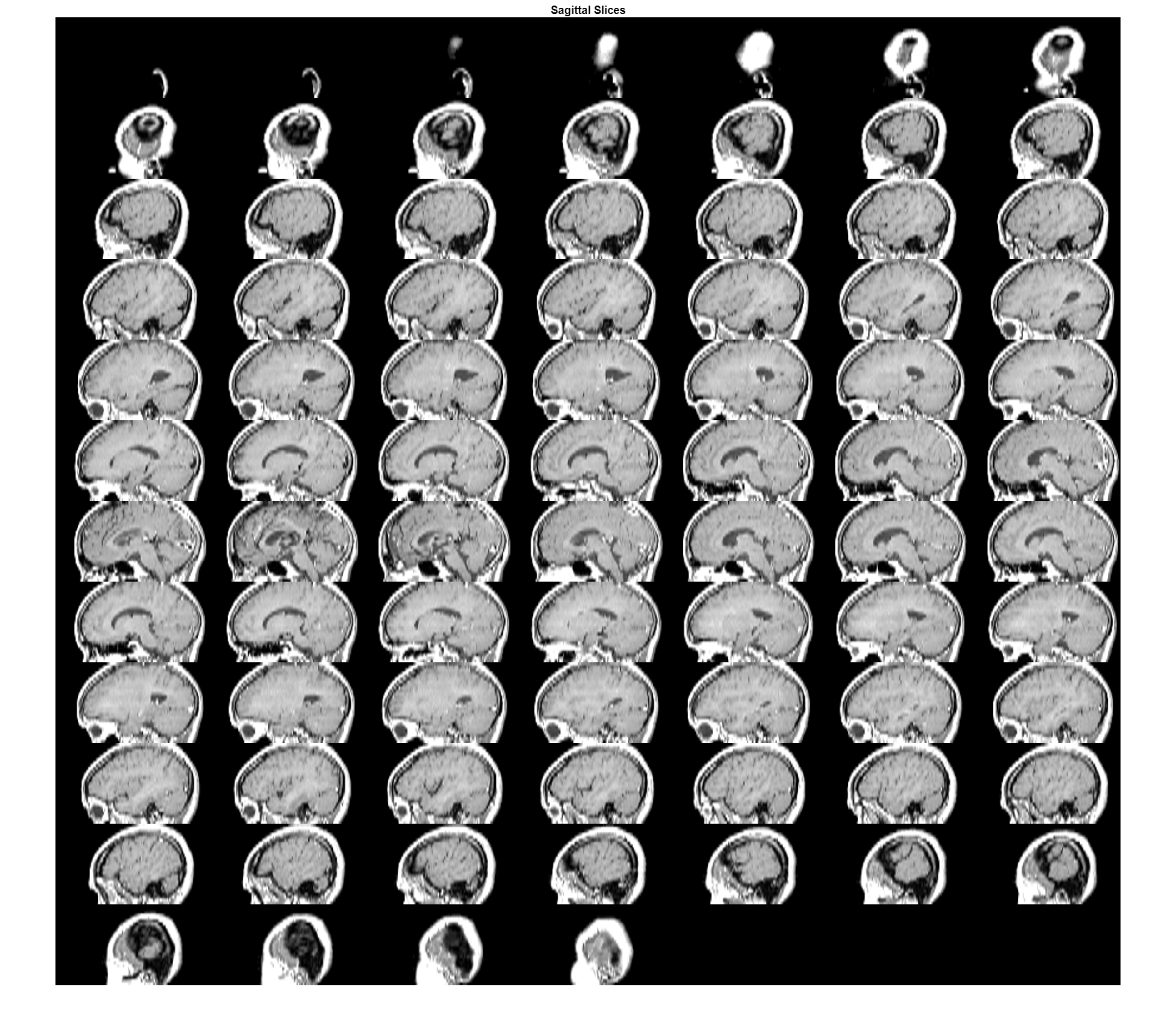 Figure contains an axes object. The hidden axes object with title Sagittal Slices contains an object of type image.