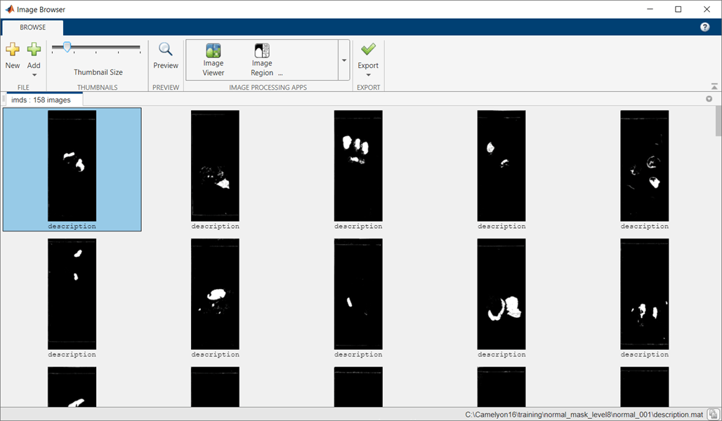 ImageBrowser_training_normal_masks.png