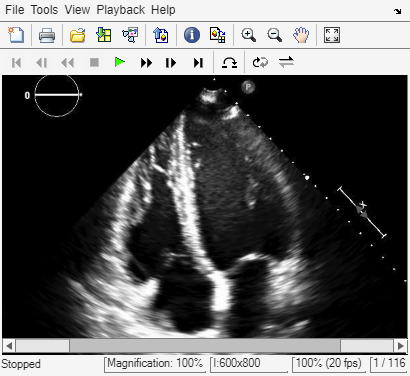 Figure Movie Player contains an axes object and other objects of type uigridlayout, uimenu, uitoolbar. The hidden axes object contains an object of type image.