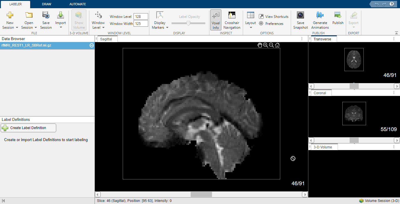 Compute Functional Connectivity from Brain fMRI