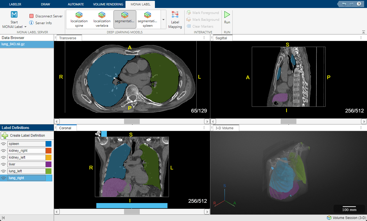 Medical Image Labeler window showing the updated segmentation model results after mapping the lung lobe models to a unified label definition for each full lung.