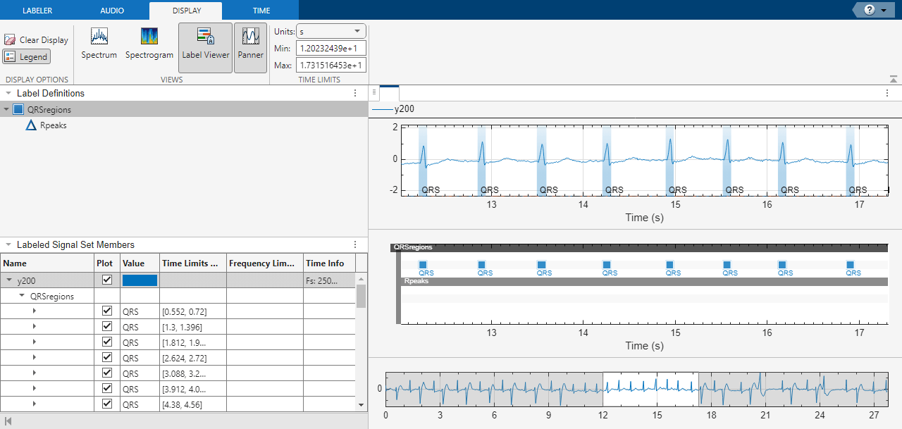 Signal Labeler app showing QRS region labels along a time span between 12 and 17.3 seconds.