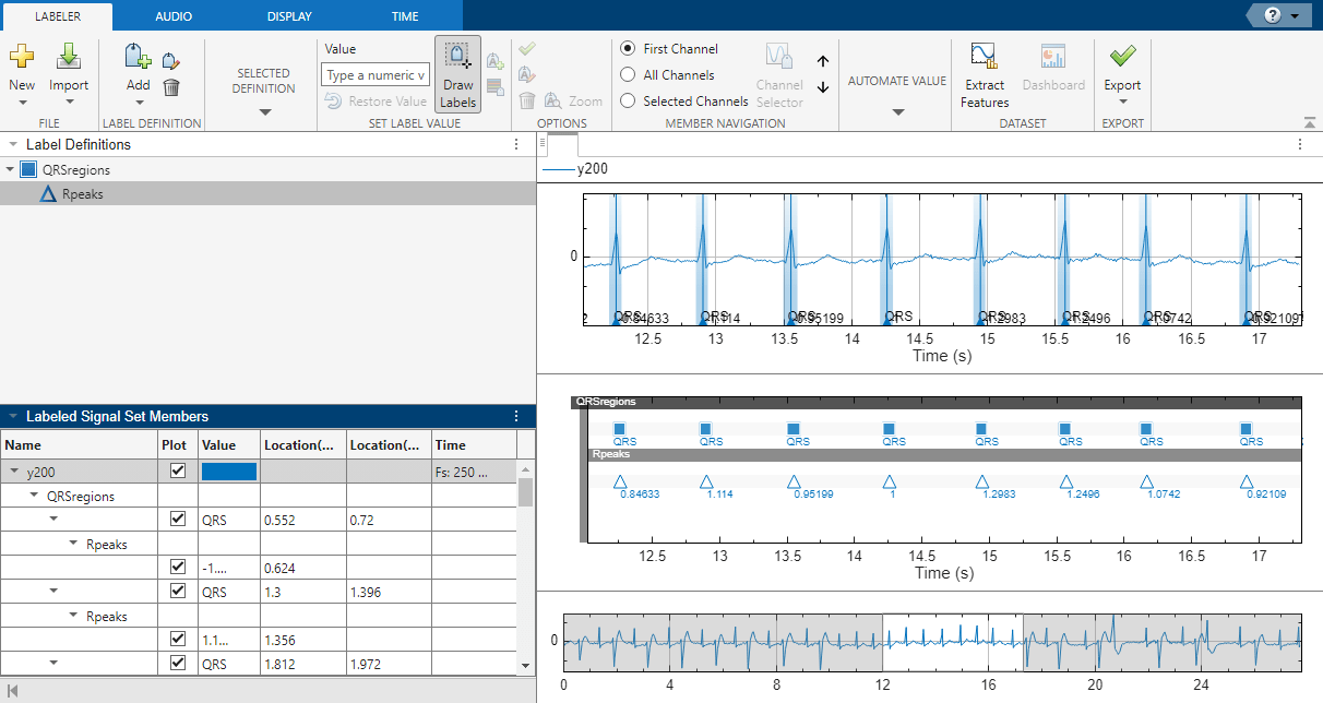 Automate Signal Labeling with Custom Functions