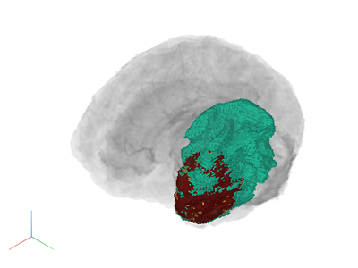 Volumetric image data displayed with a gradient opacity rendering style to reveal internal label data.